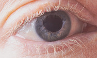 Macro-eye damage (glaucoma)